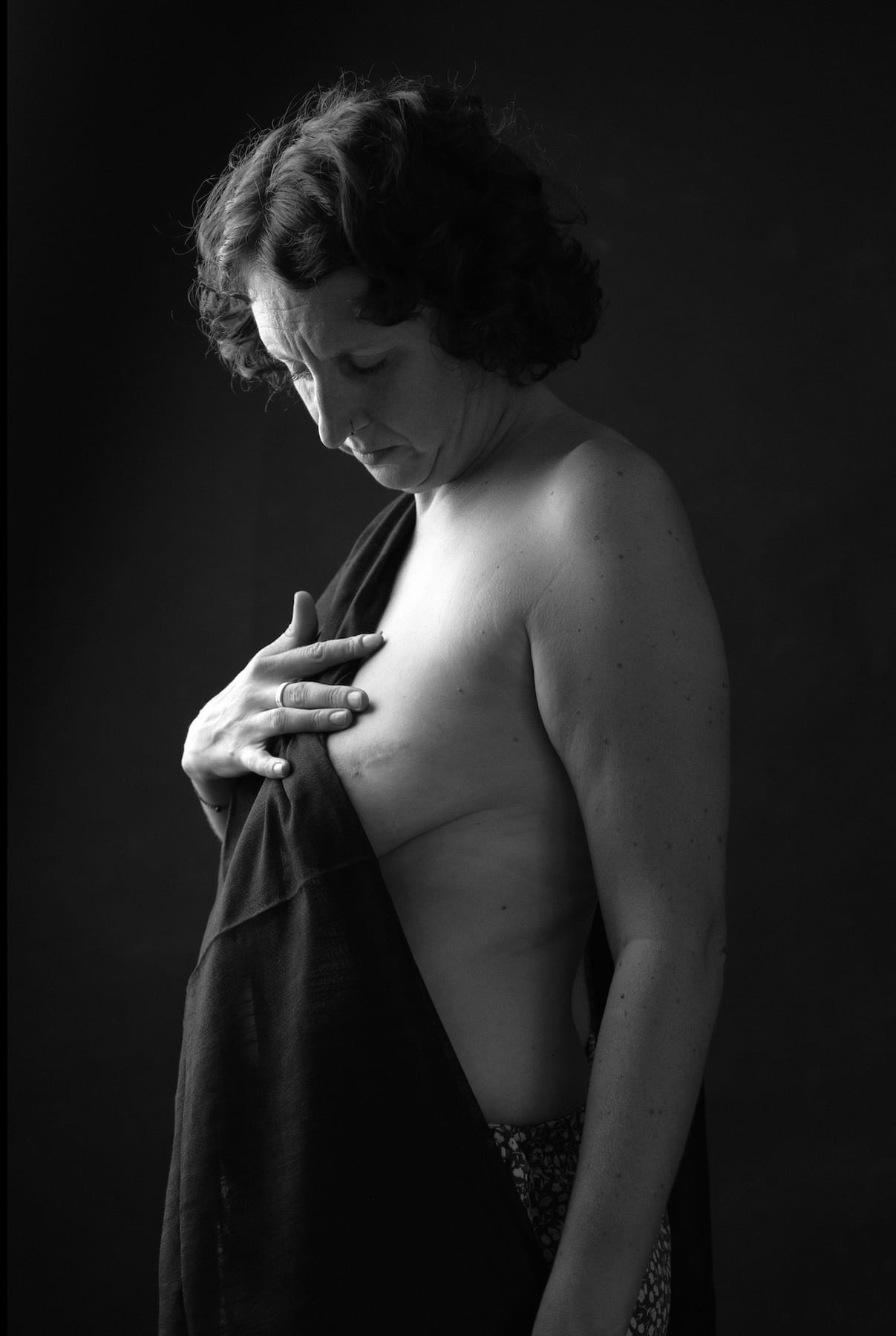 Ruhiges Self-Love-Portrait mit sichtbarer Narbe in Schwarz-Weiss